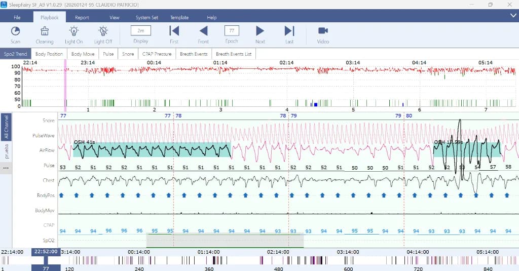 Polígrafo VentMed Sleep Fairy A9 - Vista 5